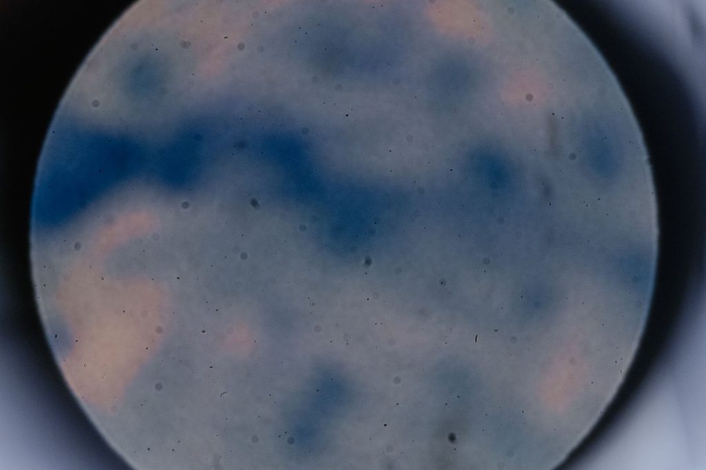 Blurred look through a microscope, showcasing abstract colors and shapes. — Stl Result